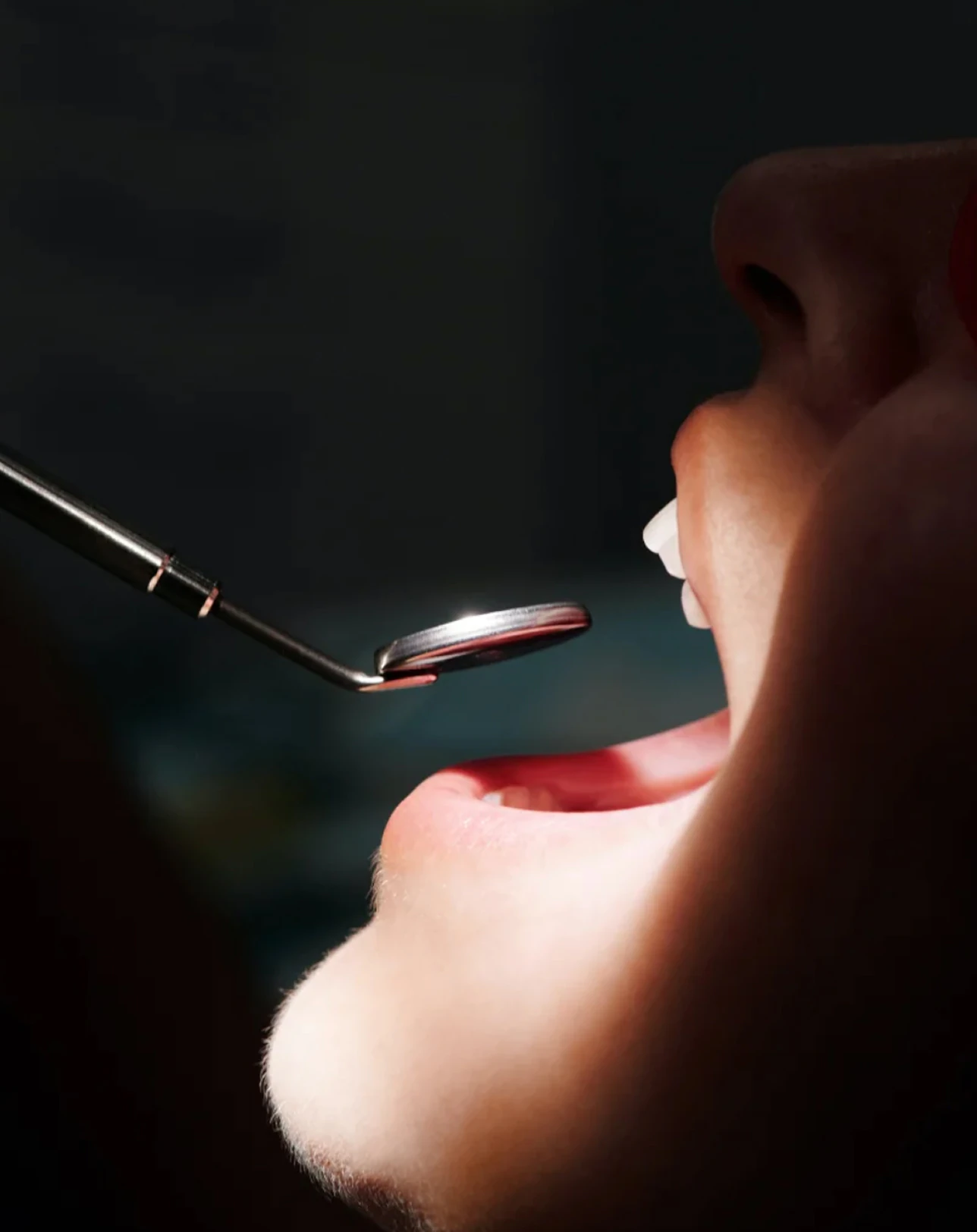Un espejo dental frente a la boca abierta de una paciente, en penumbra